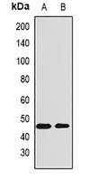 AMBP Rabbit Polyclonal Antibody