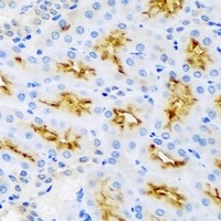 Anti-AMBRA1 Antibody