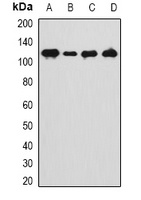 ANKRD28 Antibody