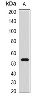 CMG2 Rabbit Polyclonal Antibody