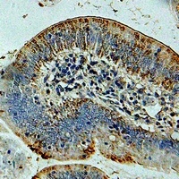 Anti-CMG2 Antibody