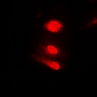 Anti-Annexin A11 Antibody