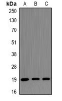 CENPS Antibody