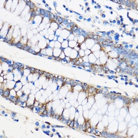 Anti-Apolipoprotein M Antibody