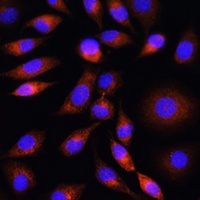 Anti-Apolipoprotein M Antibody