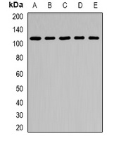 ARHGAP44 Rabbit Polyclonal Antibody