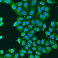 Anti-ATP5O Antibody
