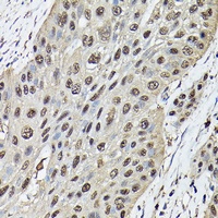 Anti-Ataxin 3 Antibody