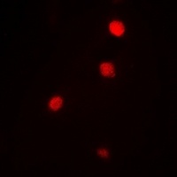 Anti-Ataxin 3 Antibody
