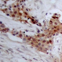Anti-BAP1 Antibody