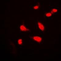 Anti-BAP1 Antibody