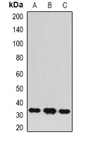 BCL10 Rabbit Polyclonal Antibody