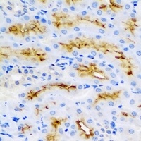 Anti-BMP15 Antibody