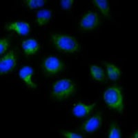 Anti-BMP15 Antibody