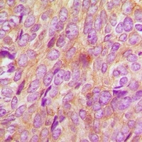 Anti-BMPR1B Antibody
