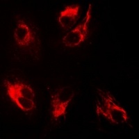 BMPR1B antibody