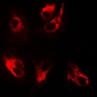 Anti-BMPR1B Antibody