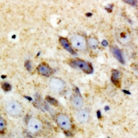 Anti-Complement C1QA Antibody