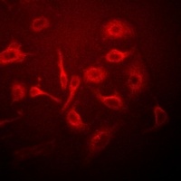 Anti-KNP-I Antibody