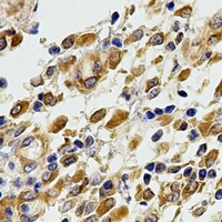 Complement C5 Antibody