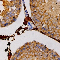 Carbonic Anhydrase 3 Rabbit Polyclonal Antibody