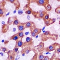 Anti-CAD Antibody