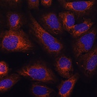 Anti-CAD Antibody