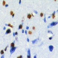 Anti-CBX8 Antibody