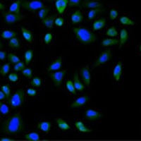 Anti-CBX8 Antibody