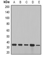 Cyclin D2 Rabbit Polyclonal Antibody