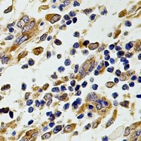 Anti-CCT2 Antibody