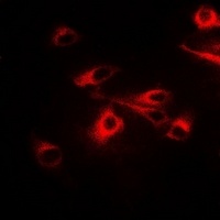 Anti-CCT2 Antibody