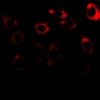 CCT3 antibody