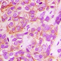 Anti-CD151 Antibody