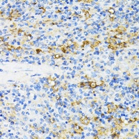 Anti-CD27 Antibody