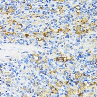 CD27 antibody