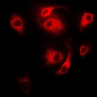 Anti-CD27 Antibody