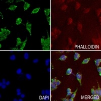Anti-CD36 Antibody
