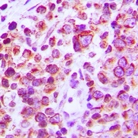 Anti-CD38 Antibody