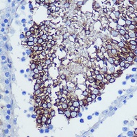 Anti-CD47 Antibody