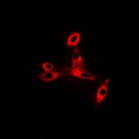 Anti-CD47 Antibody