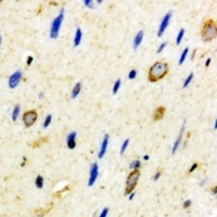 Anti-CD59 Antibody