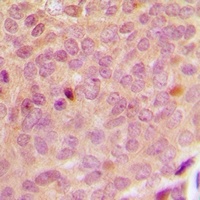 Anti-CDK20 Antibody