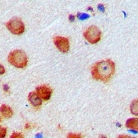 Anti-CDK6 Antibody