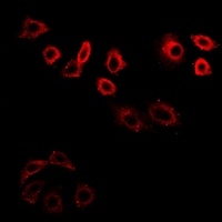 Anti-CDK6 Antibody