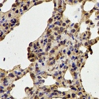Anti-CDK6 Antibody