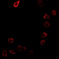 Anti-CDKN3 Antibody