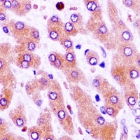 Anti-CFHR1 Antibody