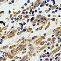 Anti-Chitotriosidase Antibody