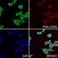 Anti-Chitotriosidase Antibody